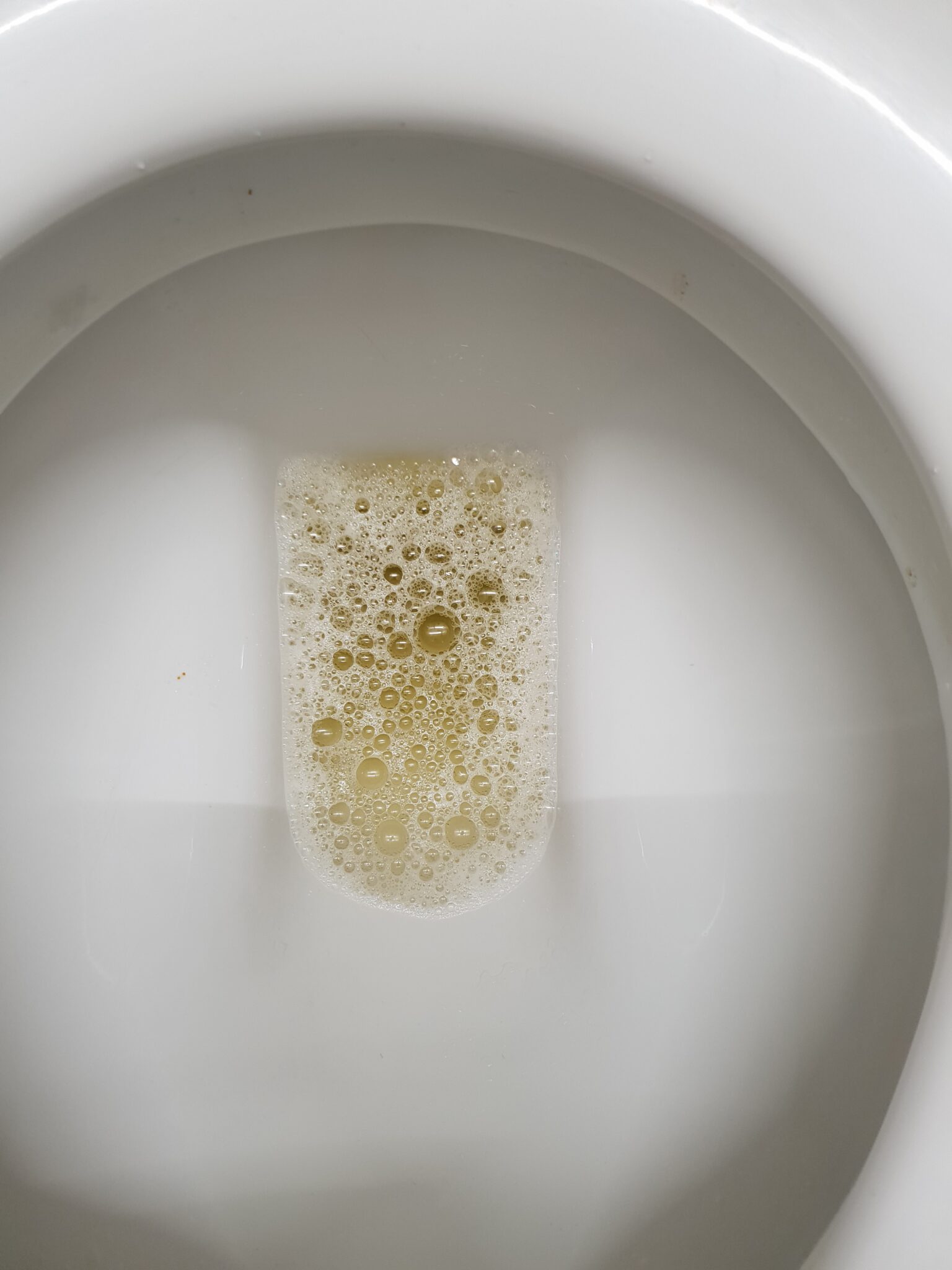 Foamy Urine On Keto? Here’s What It Means – UPDATED 2022 ...