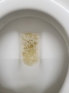foamy urine