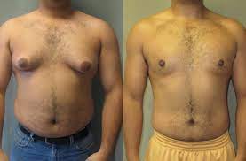 how to lose chest fat for men